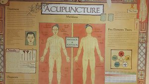 Acupuncture/Pricing. Poster